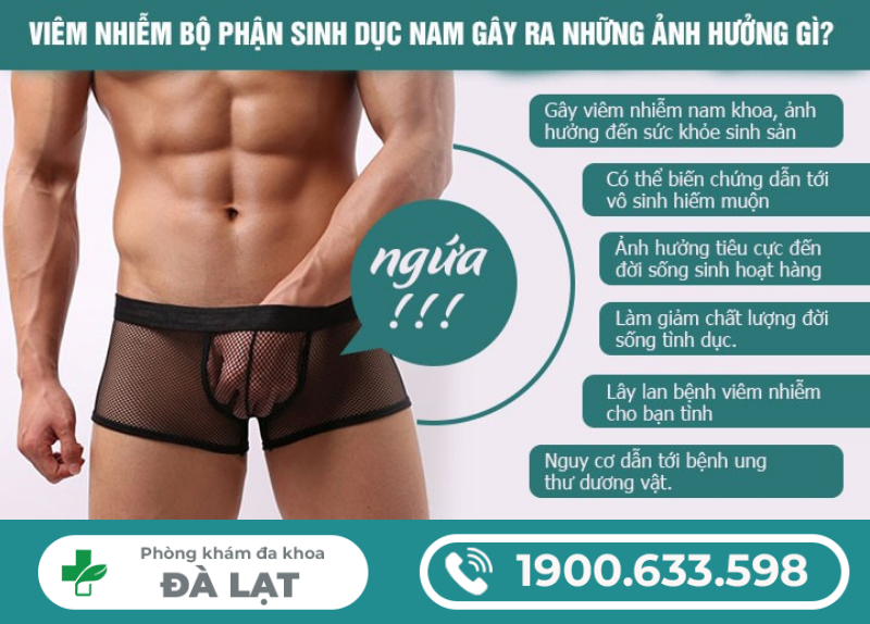 Hình ảnh minh họa
